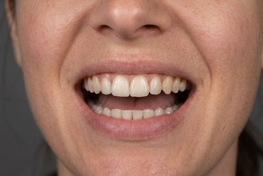 After treatment