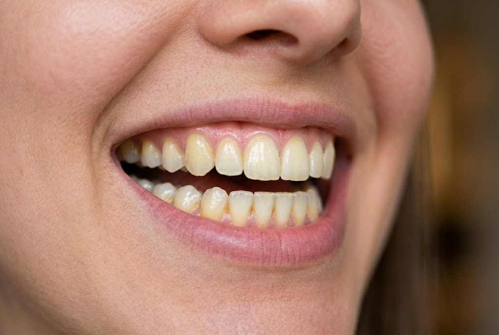 Before treatment
