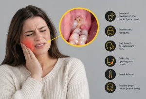 signs of wisdom tooth infection
