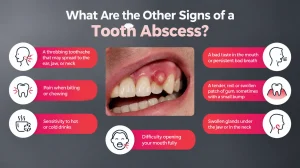 Signs of a Tooth Abscess